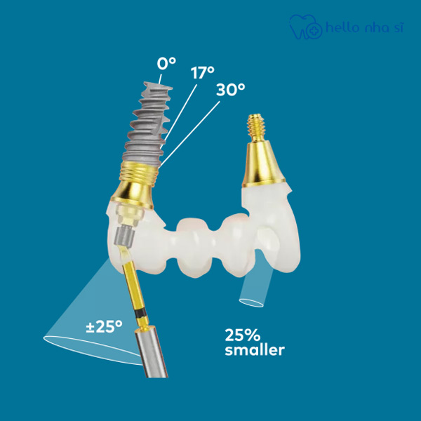 Nhiều khoảng góc giúp phục hình tốt hơn